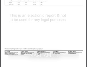 Multiple Myeloma With Ckd 5
