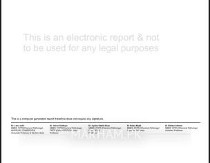 Multiple Myeloma With Ckd 5