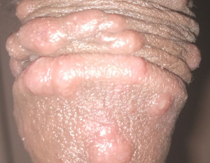 Skin Problem