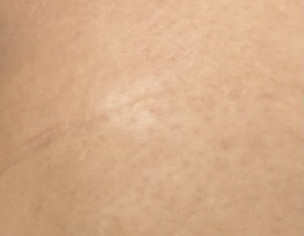 Skin Problem