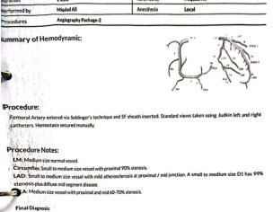 Opinion On Angiography