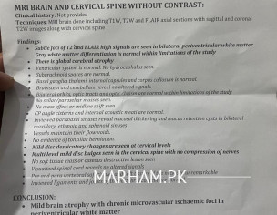 Numbness In Forehead