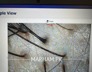 Sebum Plug And Dry Scalp