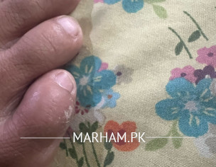 Itchy Tiny Pimples On Toe Fingers