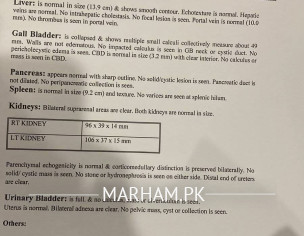 Collapsed Gallbladder