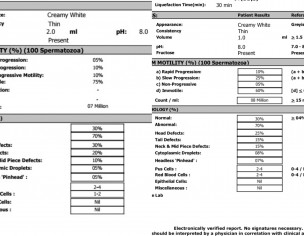 Infertility Low Sperm Count