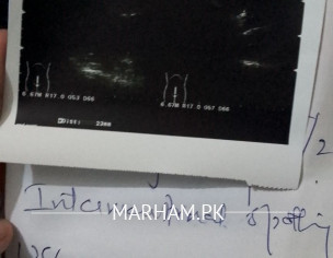 Bleeding Or Spotting