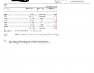 Minor Thalassemia Trait With Iron  Deficiency 