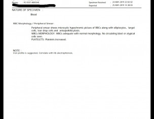 Minor Thalassemia Trait With Iron  Deficiency 