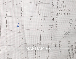 Heart Issue