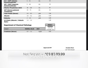 High Bp And Chestpain