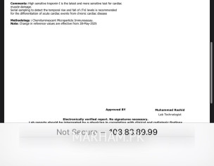 High Bp And Chestpain