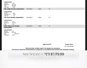 High Bp And Chestpain
