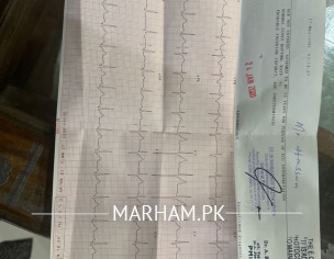 High Bp With No Symptoms 