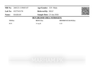 High Bp With No Symptoms 