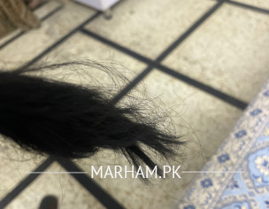 Hair Falling And Dandruff