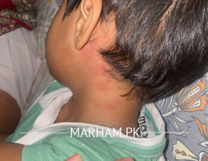 Skin Redness And Rashes 