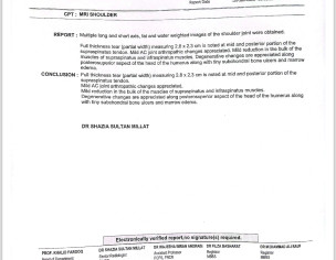 Shoulder Rotation Issue