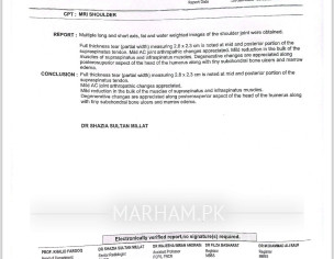 Rotator Cuff Issue ( Shoulder Joint)