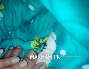 Abnormal Nail Color Change