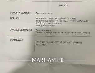 Suggestion For D@ C Or WAit