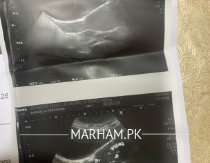 Suggestion For D@ C Or WAit