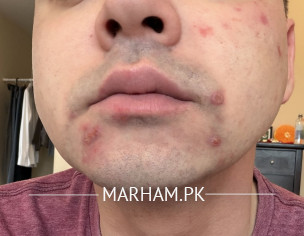 Identifying Skin Problem
