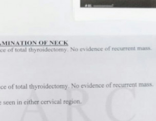 Thyroidectomy / Endocrine