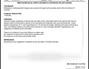 Medicines For SPA Arthritis