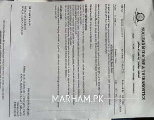 Medicines For SPA Arthritis