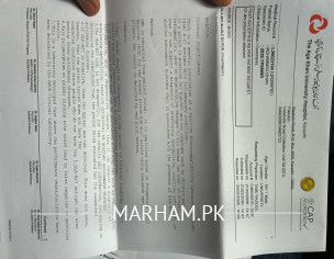 Medicines For SPA Arthritis