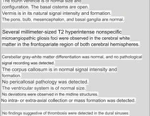 TRIGEMINAL NEURALGIA
