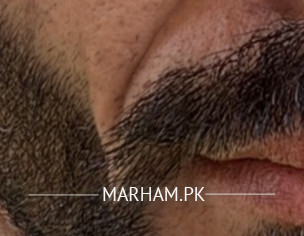 Skin Issues 