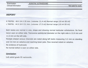 Varicocele