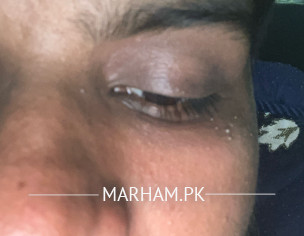 Skin Problems 
