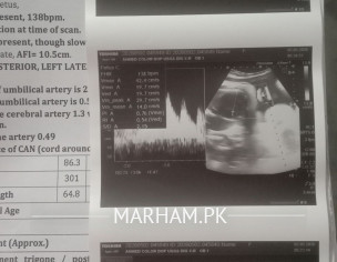 Obstetrical (Anomaly+Doppler Scan)