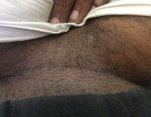 Itching Under Stomach 