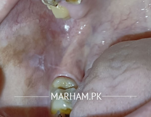 Maxoffical Surgeon