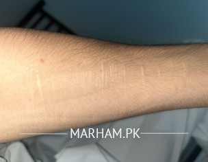 Blade Cuts On Arm