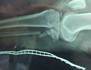 Orthopedic