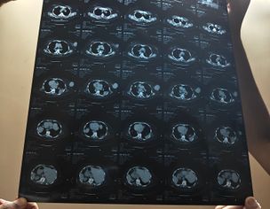 Oncologist