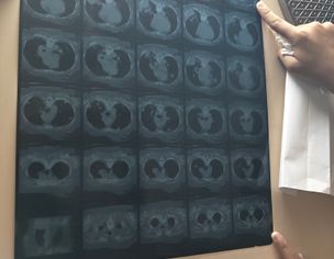 Oncologist