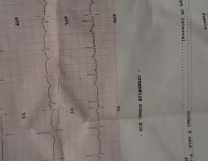 Ecg Report