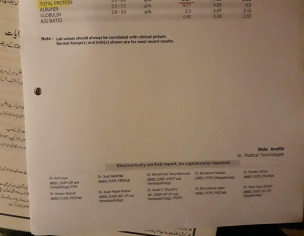 Psoriasis, Baalchar, Facial Hair Loss/hard Bumps Under Cheeks(plain On Surface)