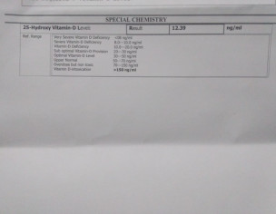 Premature Greying Of Hair