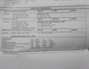 Premature Greying Of Hair