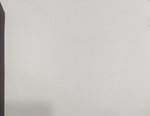 Opthomological Concern [Cataract In Both Eyes]