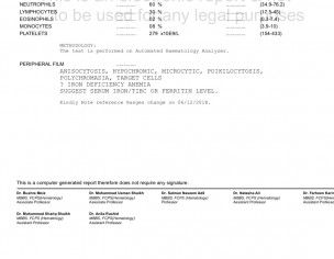 Weakness, Lethargy Anaemia