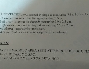 Pregnancy Or No Pregnancy