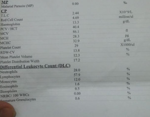 Low Platelet And  White Cells 